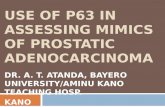Use of p63 in assessing mimics of prostatic adenocarcinoma
