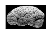 Cortex:  Cingulate Gyrus, Precentral Gyrus, Postcentral Gyrus, Primary Visual Cortex