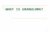 WHAT IS GRANULOMA?