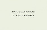 MICRO-CALCIFICATIONS   CLICHES  STANDARDS