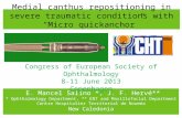 Medial canthus repositioning in severe traumatic conditions with “Micro  quickanchor ”
