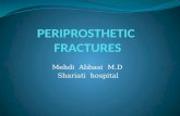PERIPROSTHETIC  FRACTURES