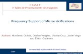 Frequency Support of Microcalcifications
