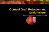 Corneal Graft Rejection and Graft Failure