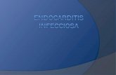 Endocarditis  Infecciosa