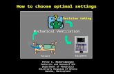 How to choose optimal settings