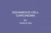 SQUAMOUS CELL CARCINOMA