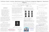 Inferior Brain Lesions Monitored Using Diffusion Weighted Magnetic Resonance Imaging