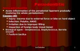 Periodontitis Acute periodontitis
