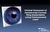 Clinical Outcomes of Intrastromal Corneal Ring Implantation using Femtosecond Laser