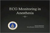 ECG Monitoring in Anesthesia