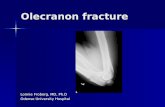 Olecranon fracture