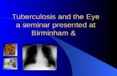 Tuberculosis and the Eye a seminar presented at Birminham &