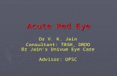 Acute Red Eye