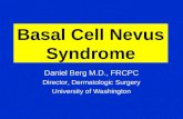 Basal Cell Nevus Syndrome