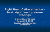 Right Heart Catheterization – basic right heart pressure tracings