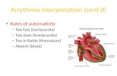 Arrythmia Interpretation (cont’d)