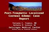 Post-Traumatic Localized Corneal Edema: Case Report