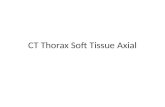 CT Thorax Soft Tissue Axial
