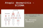 Atopic dermatitis - ECZEMA