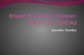 Breast & Ovarian Cancer: BRCA1 and BRCA2