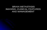 BRAIN METASTASIS IMAGING ,CLINICAL FEATURES  AND MANAGEMENT