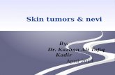 Skin tumors & nevi