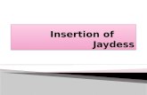 Insertion of       Jaydess