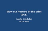 Blow out fracture of the  orbit (BOF)