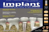 Implant Practice US Jan-Feb 2013 Vol 6 No 1