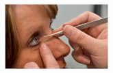 Treating eye floaters naturally