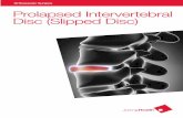 Orthopaedic Surgery - Prolapsed Intervetebral Disc (Slipped Disc)