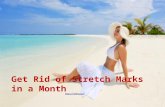 Get Rid Of Stretch Marks in a Month