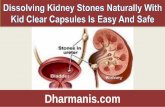Dissolving Kidney Stones Naturally With Kid Clear Capsules Is Easy And Safe