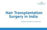 Hair Transplantation Surgery in India | Radiance