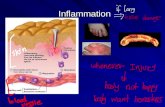 2. Acute Inflammation