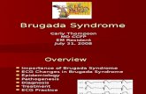 Brugada Syndrome ECG