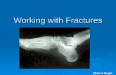 Working with Fractures Click to Begin. Working with Fractures Click to Continue.