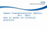 Human Transplantation (Wales) Act 2013. How it works in clinical practice.