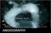 ANGIOGRAPHY. Your Hearts Electrical System Lubb The sinoatrial node fires. The signal is sent through to both atriums which contract pushing blood into.