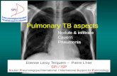Pulmonary TB aspects Etienne Leroy Terquem – Pierre L’Her SPI / ISP Soutien Pneumologique International / International Support for Pulmonology Nodule.