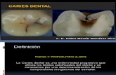 Caries Dental Finall 0214 000