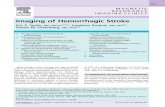 Imaging+of+Hemorrhagic+Stroke OK BGT
