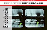 Reportes Especiales - Endodoncia