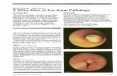 A Mini-Atlas of Ear-drum Pathology.pdf