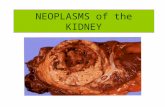 Uki 3 Neoplasms New of the Kidney Modf