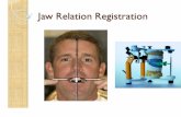 Jaw Relation Registration