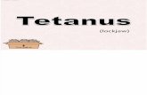 Tetanus Case Presentation