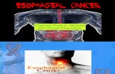 Hema Report- Esophageal Cancer