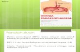 Referat Hernia Paraesophageal-rev